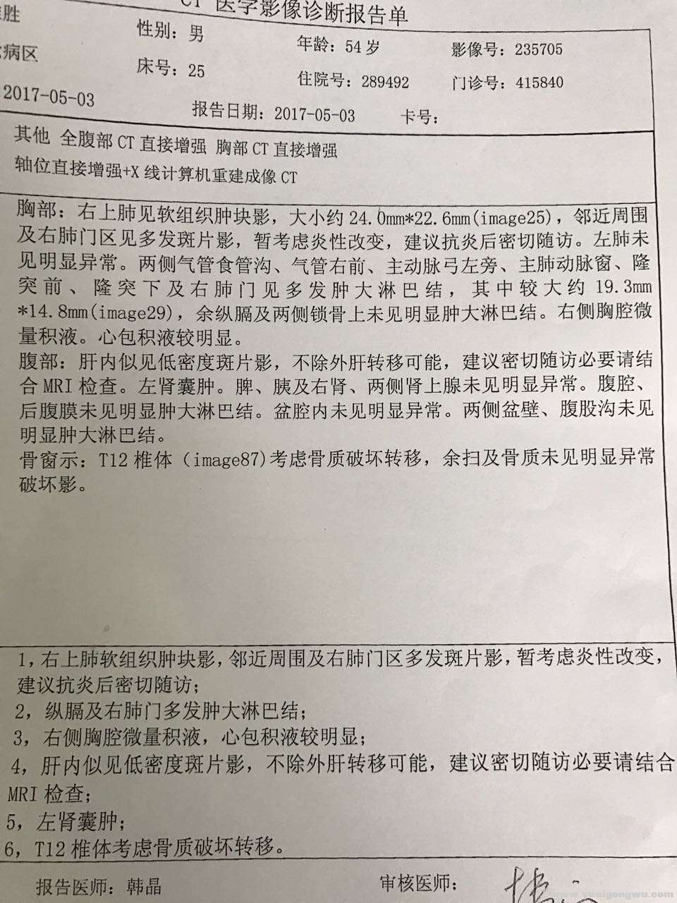 PETCT结果多处转移