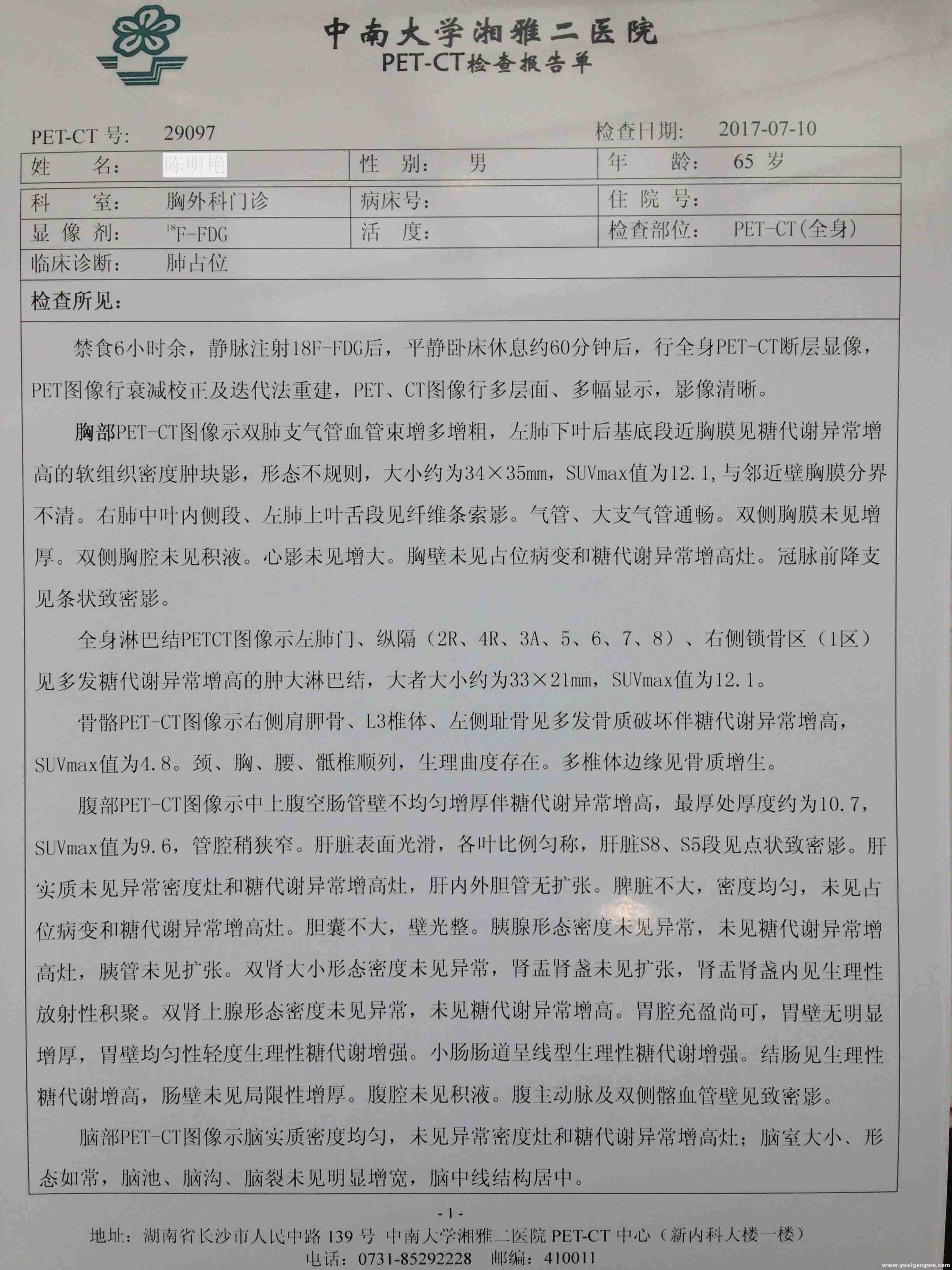 3PET-CT检查报告单1湘雅二医院SE.JPG