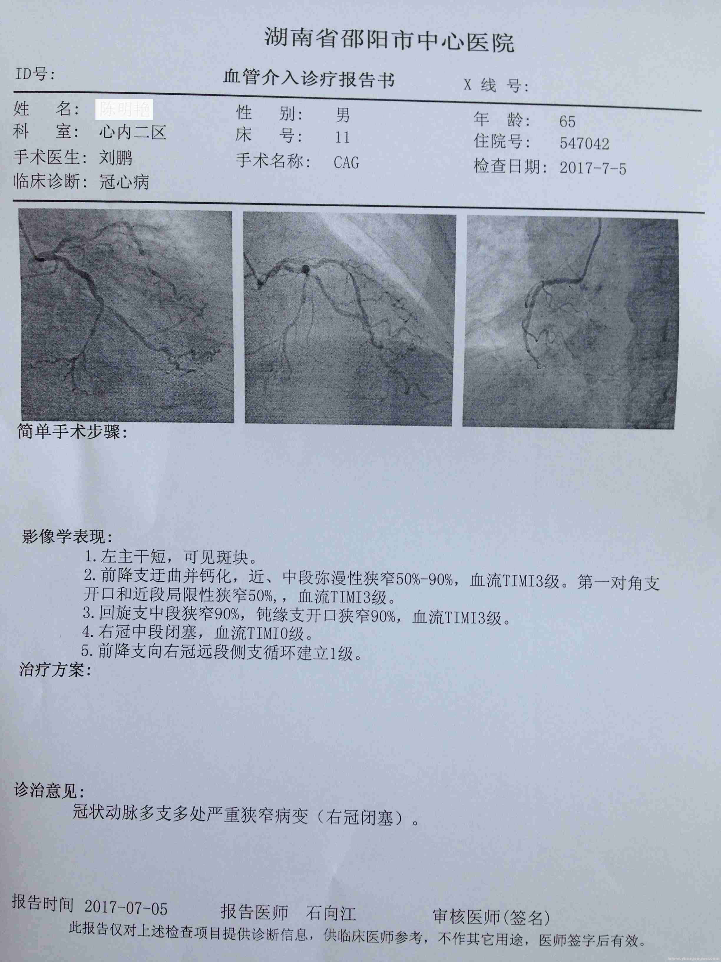 血管介入诊疗报告书 中心医院SE.JPG